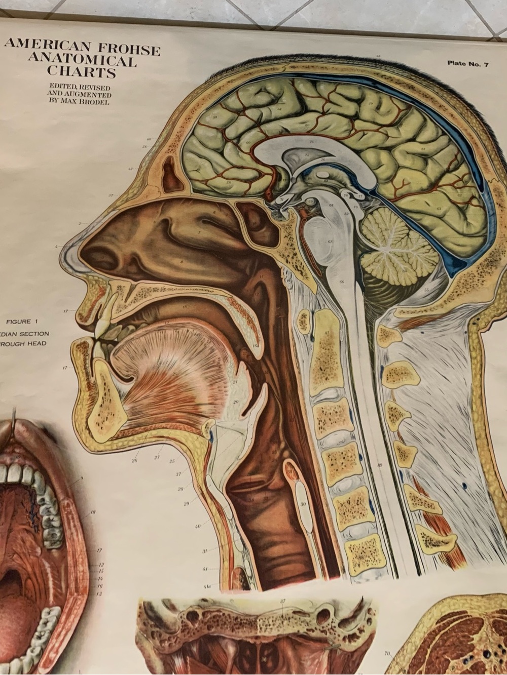 Antique American Frohse Anatomical Chart Head and Neck Signed Max Brotel 1919 - Picture 3 of 16